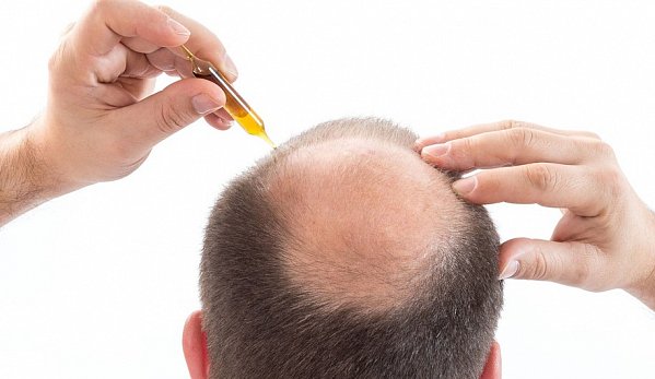 Препараты против выпадения волос - причины и лечение